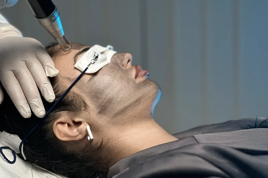 The Curas Hybrid Device for Pigmentation Treatment and Skin Renewal
