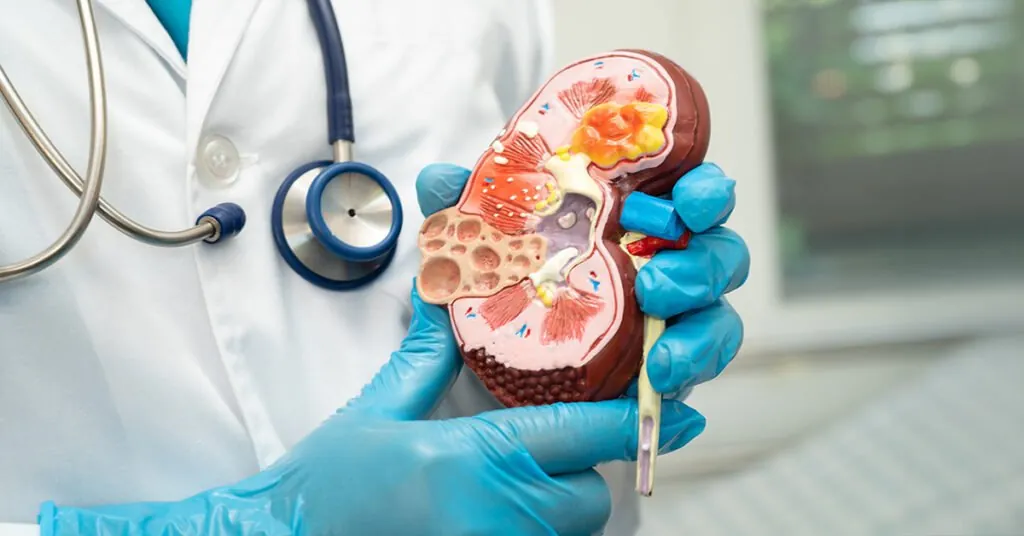 Treating kidney stones and flank pain