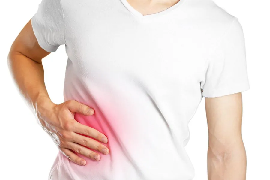 Kidney Stones and Flank Pain