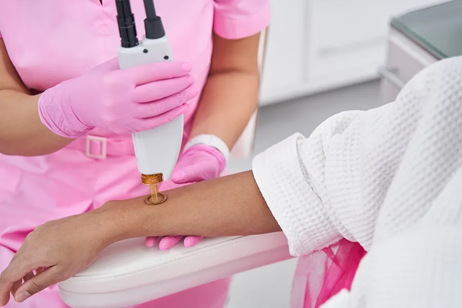 Laser Hair Removal in Qatar