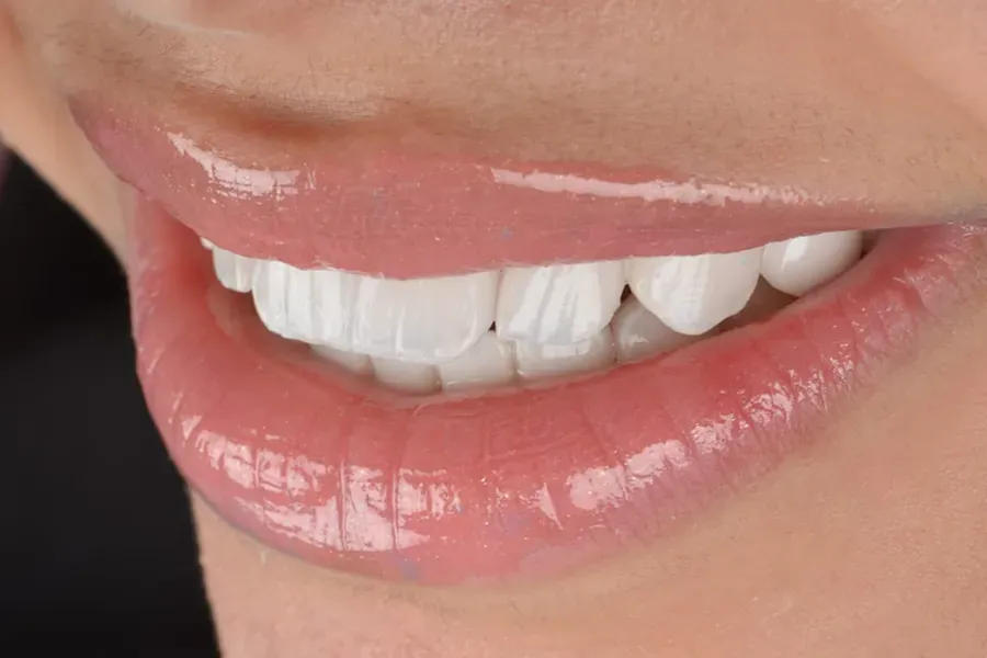 Modern Techniques in Cosmetic Dentistry