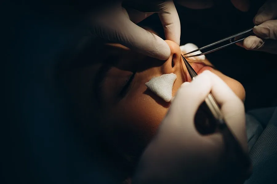 Rhinoplasty: Reasons and Types