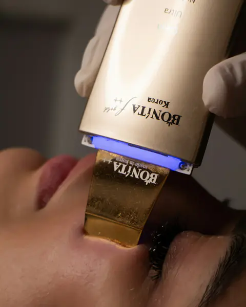 جهاز كيوراس هايبرد imagery, dermatology-linked technology visuals at Almahmoud Medical Group in Qatar (3)