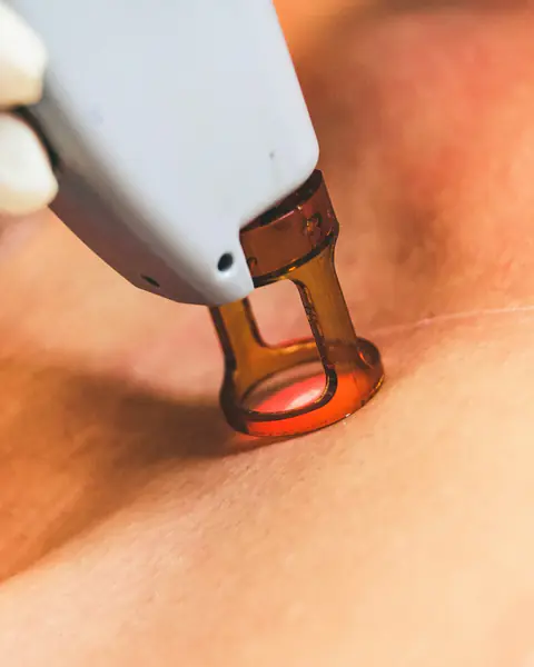 جهاز سينوشور إيليت آي كيو imagery, dermatology-linked technology visuals at Almahmoud Medical Group in Qatar (1)