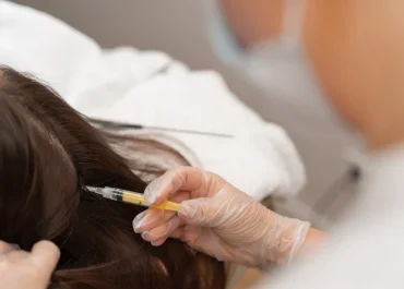 تقنية جي سيل لعلاج تساقط الشعر, medical technology at Almahmoud Medical Group in Qatar