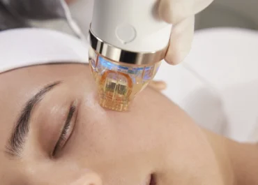 جهاز سيكريت آر إف, medical technology at Almahmoud Medical Group in Qatar
