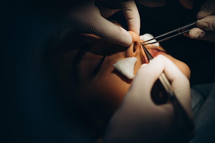 عملية تجميل الأنف، أسبابها وأنواعها